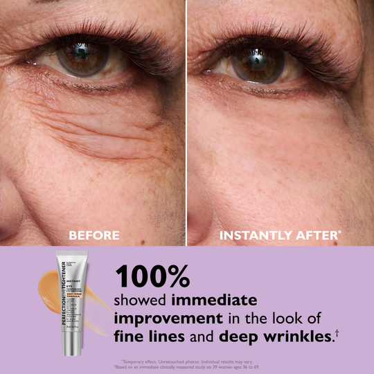 Final 3 Hours: 60%OFF🔥 Instant Eye Tightener Easy-Wear Formula With Brush Free!