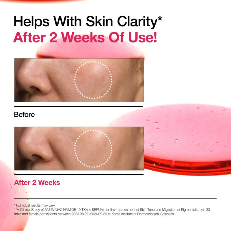 [חנות רשמית של Anua] סרום לתיקון כתמים כהים: 10% ניאצינאמיד + 4% חומצה טרנקסמית 1.01 fl.oz30 מ&quot;ל | סרום ניאצינאמיד, מוצר טיפוח לעור PM, היפרפיגמנטציה, הבהרה