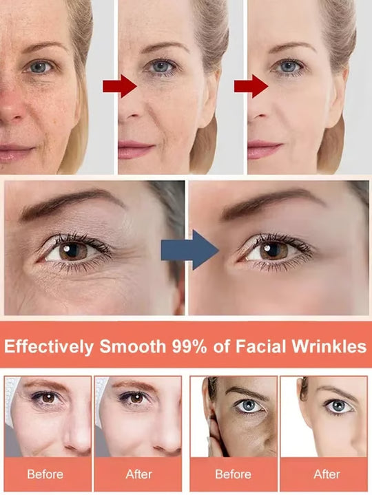 Crema facial antiarrugas profesional [Antiarrugas y reducción del amarillamiento]💦