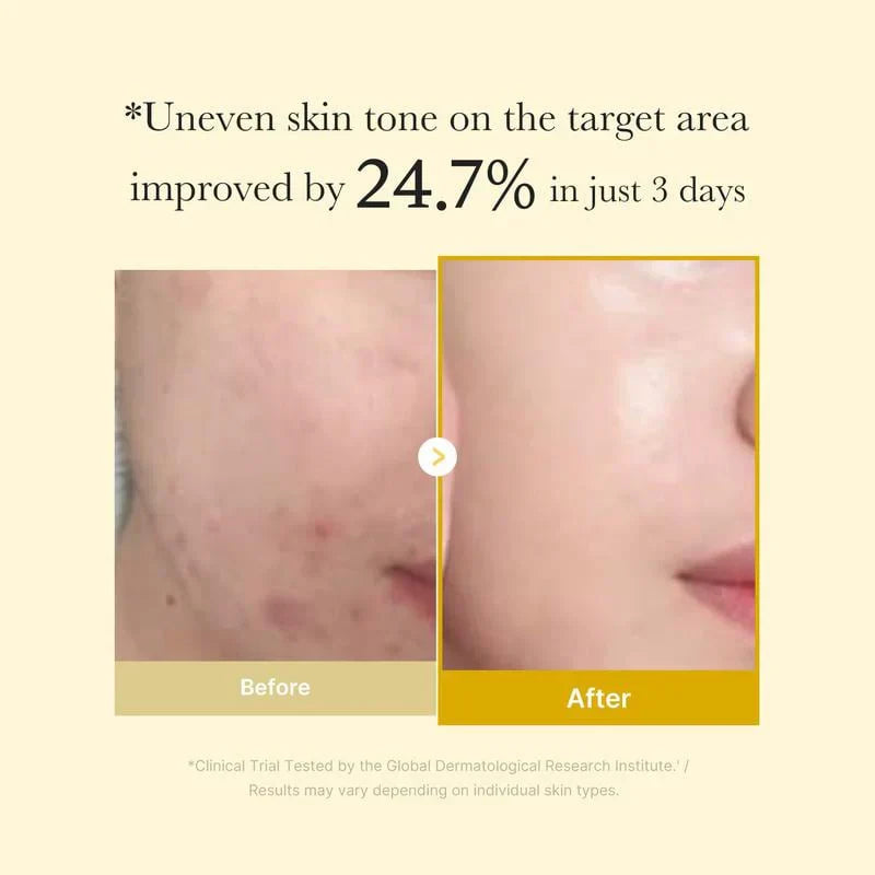 [Medicubeofficial] Kojic Acid Gurmeric Night Wrapping Mask | Overnatt Wrapping Mask, Morning Shed, Gurkmeja, niacinamid, C -vitamin