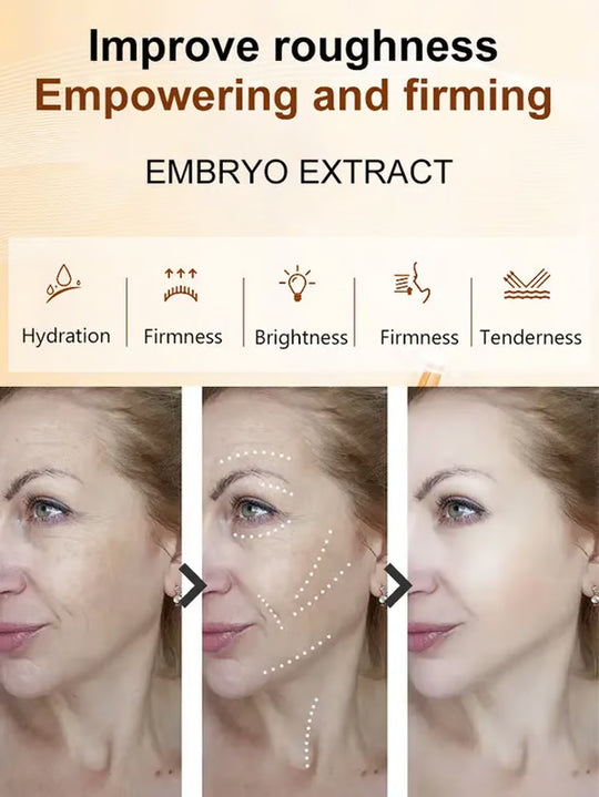 Crema facial antiarrugas profesional [Antiarrugas y reducción del amarillamiento]💦