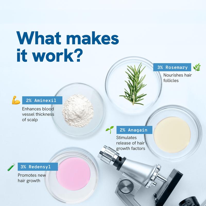 Fii avansat în corp de creștere a părului Roll-on | 3% rozmarin | 2% aminexil | 3% Redensy L 2% Anagain | Aplicator de scalp de precizie | Paraben și Sulfat gratuit | Non -uleios și fără mizerie