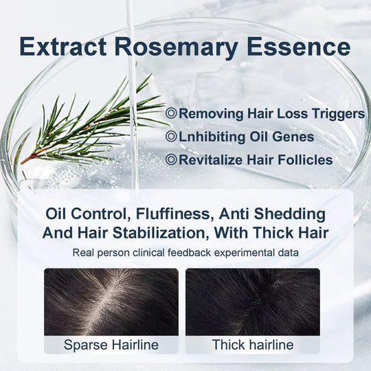 Tgideas Rosemary Shampoo-450ML