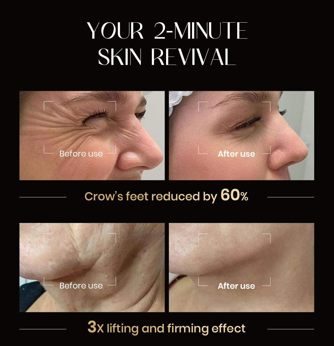 🏆Flash Sale⚡20K+ SOLD! Almost Gone💥Firming & Hydrating Anti-Wrinkle Serum