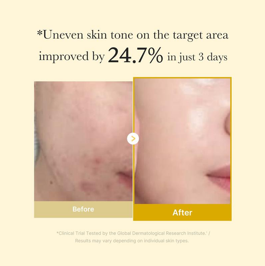 [MedicubeOfficial] Maschera di avvolgimento della notte della curcuma dell'acido kojic | Maschera da involucro durante la notte, capannone del mattino, curcuma, niacinamide ， vitamina C