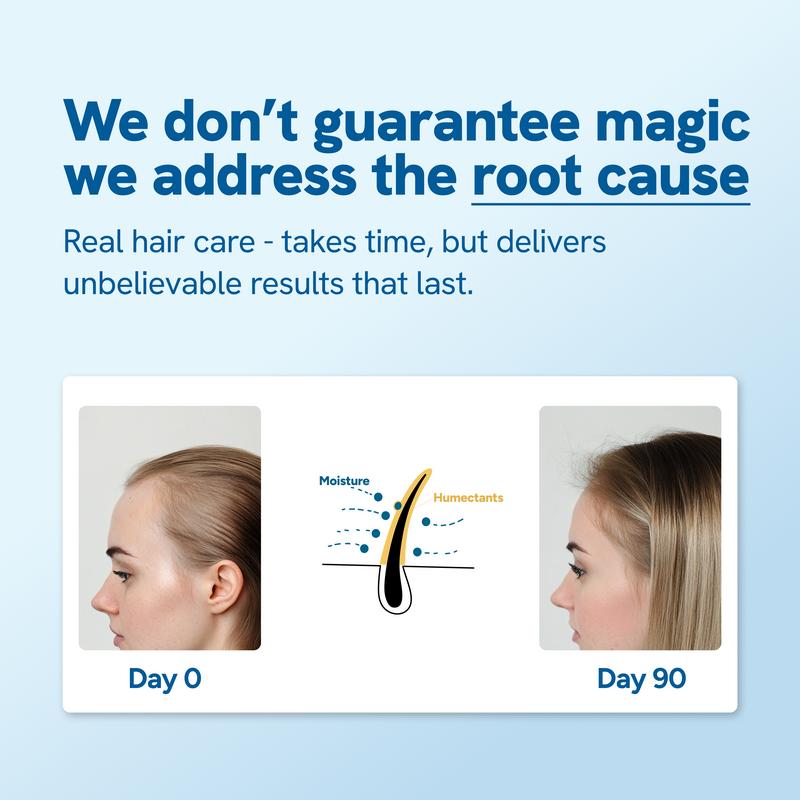 Fii avansat în corp de creștere a părului Roll-on | 3% rozmarin | 2% aminexil | 3% Redensy L 2% Anagain | Aplicator de scalp de precizie | Paraben și Sulfat gratuit | Non -uleios și fără mizerie