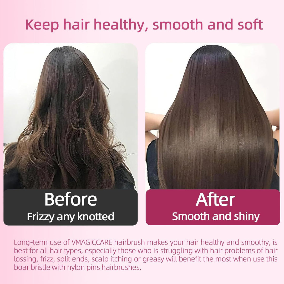 VMAGIC Detangling hajkefe fejbőr fésű női lányoknak, férfiaknak & fiúknak, nedves és száraz hajra, kétszintű fogak az erőfeszítés nélküli, hosszan tartó fogak eltávolításához