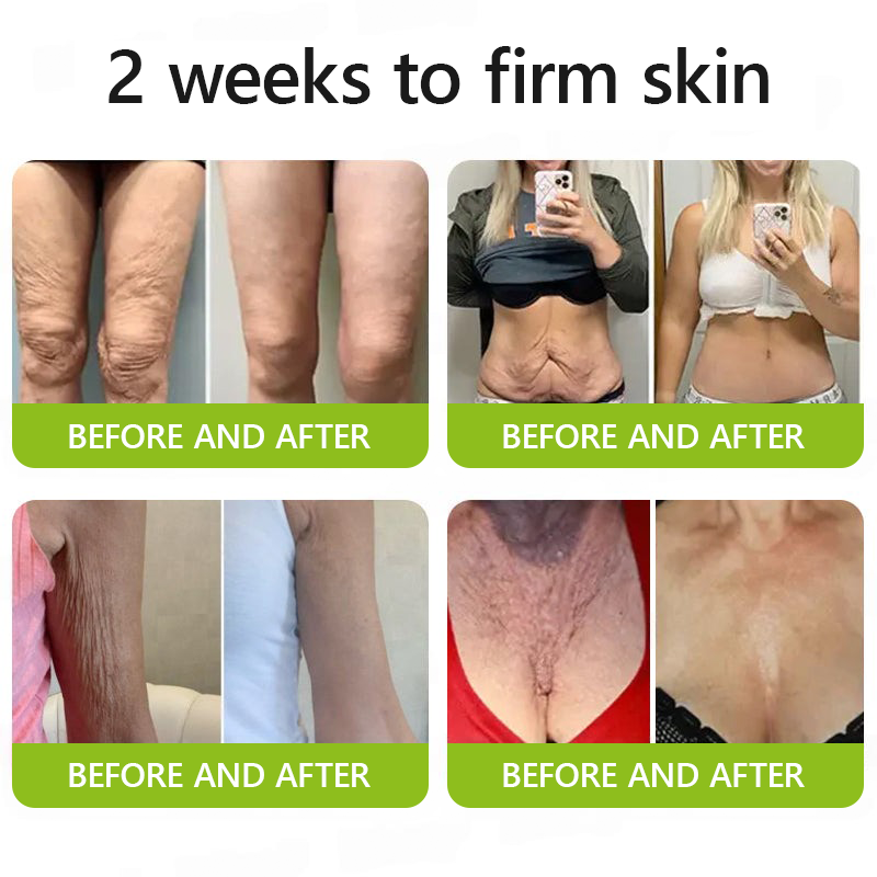 𝑶𝒇𝒇𝒊𝒄𝒊𝒂𝒍 𝑺𝒕𝒐𝒓𝒆👍| Regain youthful skin nown 💫STDEI® BOTOX & VITA A RETINOL SHOT Wrinkle Lift Tightening Cream