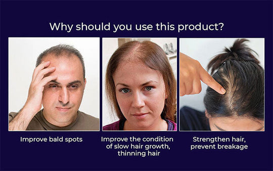 🖤Crni petak: 40% popusta🖤 HZA™ Sprej za ponovni rast prirodne kose