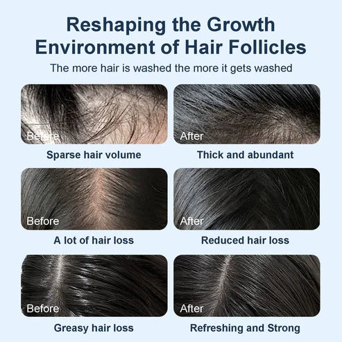 Tgideas Rosemary Shampoo-450ML