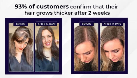 🖤Crni petak: 40% popusta🖤 HZA™ Sprej za ponovni rast prirodne kose