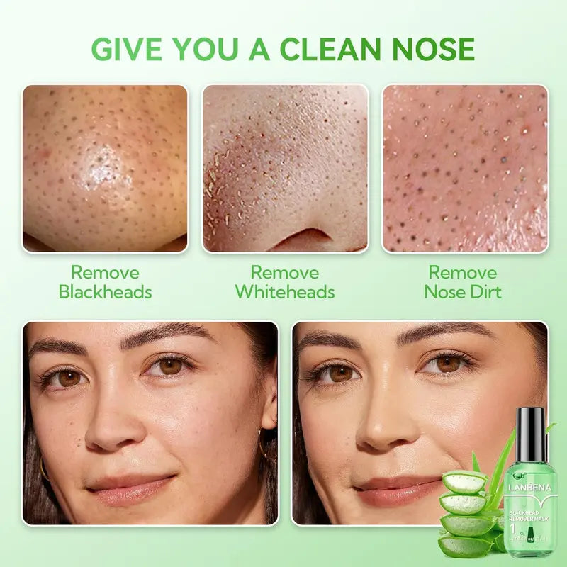LANBENA Trakice za uklanjanje mitesera s okusom zelenog čaja, 100 listova & Serumska maska ​​za minimiziranje pora, za pore, nos i bradu & Lice