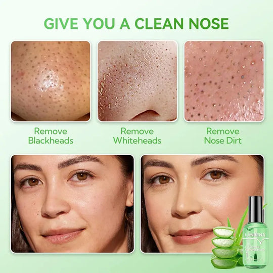 LANBENA Trakice za uklanjanje mitesera s okusom zelenog čaja, 100 listova & Serumska maska ​​za minimiziranje pora, za pore, nos i bradu & Lice