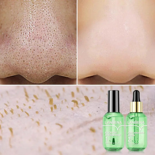 LANBENA Trakice za uklanjanje mitesera s okusom zelenog čaja, 100 listova & Serumska maska ​​za minimiziranje pora, za pore, nos i bradu & Lice