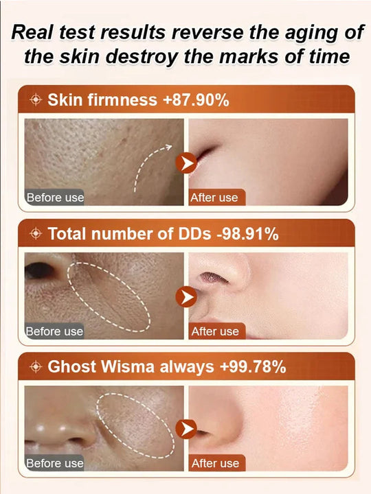 🔥Viimeisenä päivänä osta yksi, saat toisen ilmaiseksi 🔥Ecdoin ikääntymistä estävä essenssi