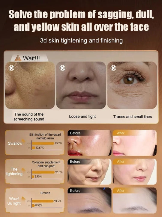 Lingzhi-ryppyjä ehkäisevä nuorentava vesi💦