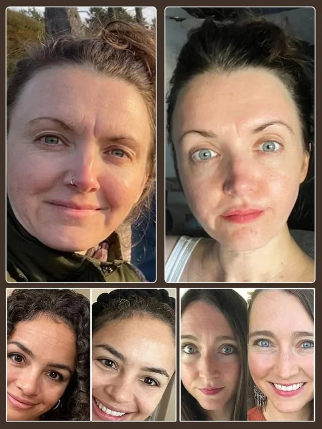 【Yhdellä kosketuksella ryppyjen poistaminen】Mikromolekyylinen kollageeni ryppyjä ehkäisevä voide