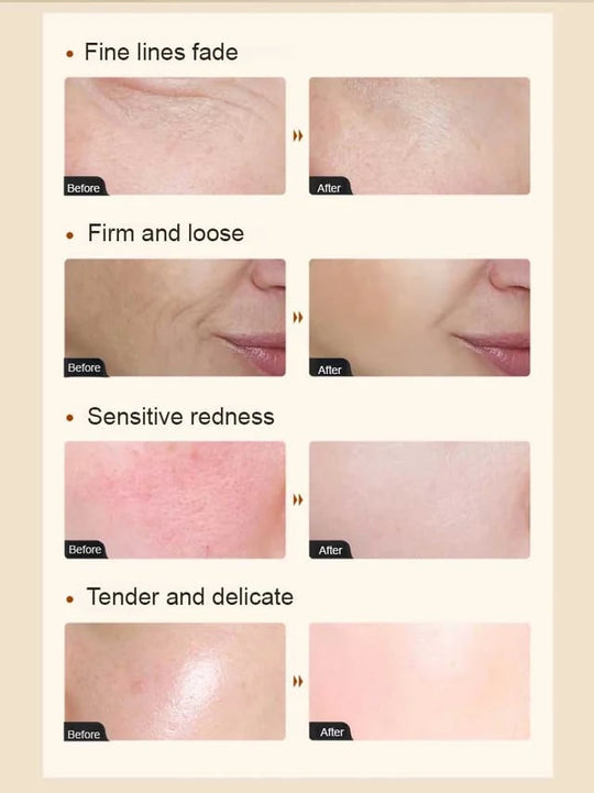 [Sredstvo protiv rasta kože] Kolagen esencija protiv bora💦