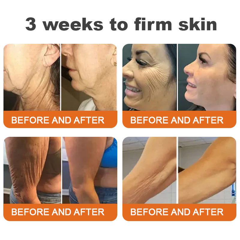 🧑‍⚕️𝑶𝒇𝒇𝒊𝒄𝒊𝒂𝒍 𝑺𝒕𝒐𝒓𝒆 | 𝐑𝐨𝐥𝐢𝐦𝐞𝐲® 𝐁𝐨𝐭𝐨𝐱 𝐁𝐞𝐞 𝐕𝐞𝐧𝐨𝐦 𝐅𝐢𝐫𝐦𝐢𝐧𝐠 𝐒𝐞𝐫𝐮𝐦 𝐒𝐭𝐢𝐜𝐤 - 𝐓𝐚𝐫𝐠𝐞𝐭𝐬 𝐒𝐚𝐠𝐠𝐢𝐧𝐠 𝐒𝐤𝐢𝐧 &  Det er ikke engang, du kan lide det. 𝐑𝐞𝐬𝐮𝐥𝐭𝐬 𝐢𝐧 𝟑 𝐃𝐚𝐲𝐬