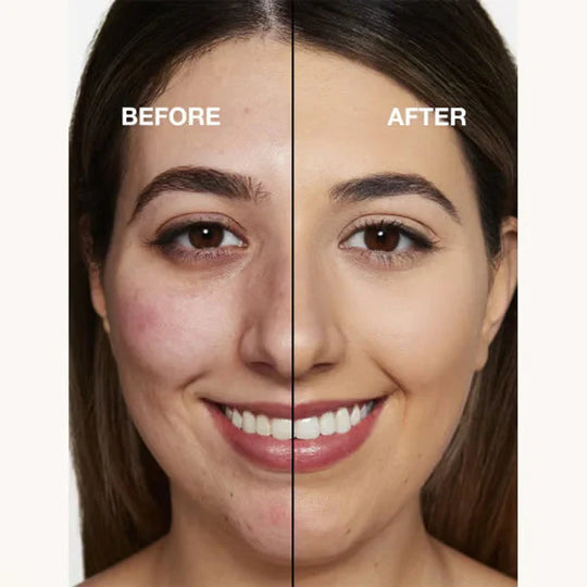 🏆Flash Sale⚡ 50K+ SOLD! Almost Gone - Foundation 4 in 1 - Medium Spectrum