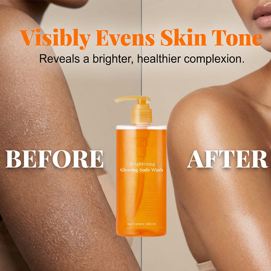 [NOVO] Osvetljevalna čistilna voda za telo s kurkumo Kojic Acid Vita | Za problematično kožo, neenakomerno kožo | K-Beauty nežno čistilo, gel za umivanje telesa, korejska nega kože
