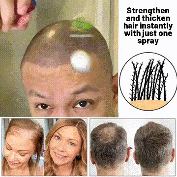 🖤Crni petak: 40% popusta🖤 HZA™ Sprej za ponovni rast prirodne kose