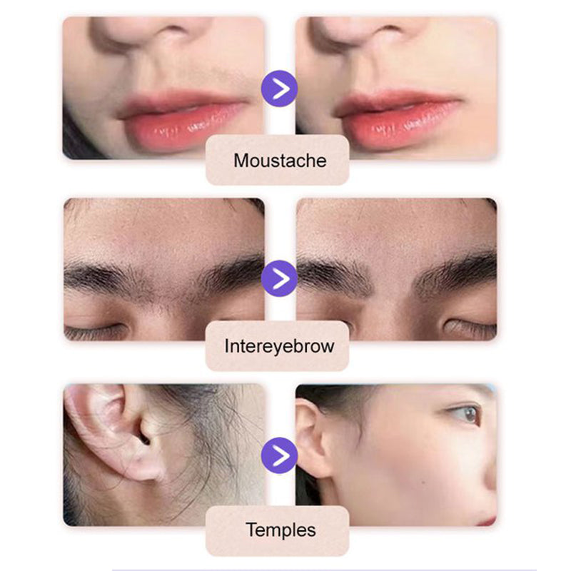 🔥Acquista 2 e ricevi 1 gratis🔥Crema depilatoria delicata e indolore per il viso