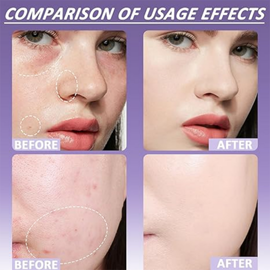 🏖️Kaufen Sie 2 und erhalten Sie 1 gratis🌞Matter Concealer für Tattoos und Narben