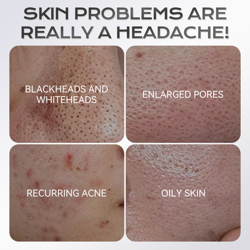 40g Azelaic Acid Clay Mask Stick