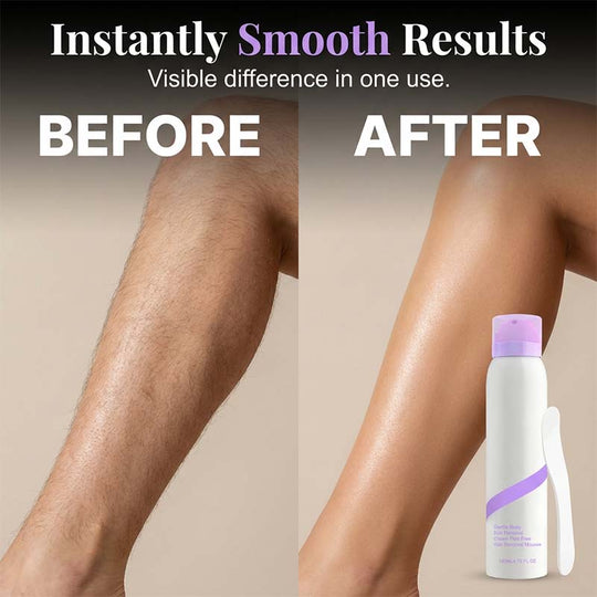 💜KLENIMORE™ Suave &  Dúo de cremas depilatorias indoloras para piel sensible